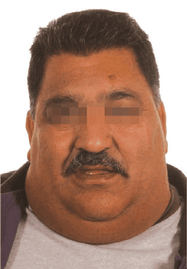 수면무호흡증 훑어보기 이미지 3