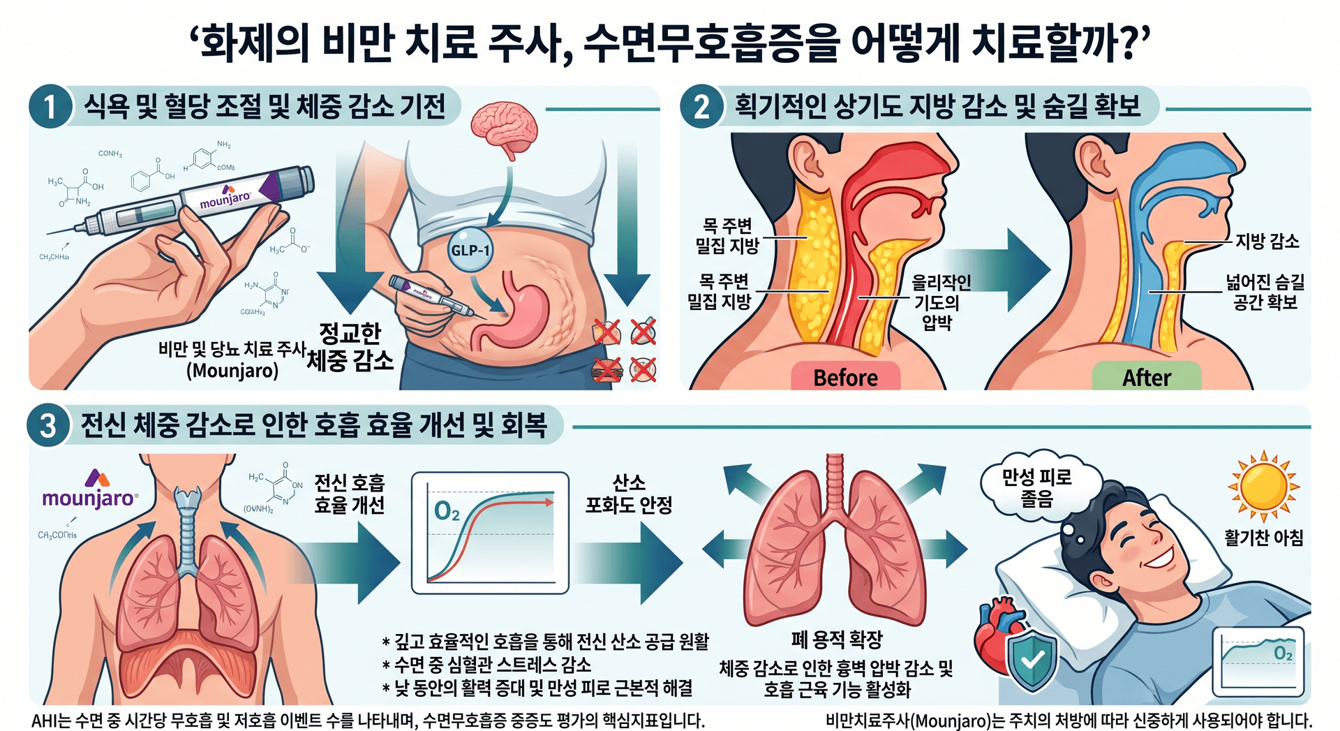 수면무호흡증 환자라면, 비만 주사 실비보험 적용 가능할까? (인천 수면다원검사, 인천 마운자로처방)