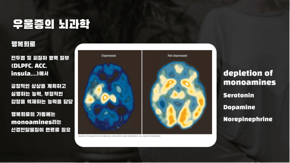 직무스트레스를 완성 시키는 것들 (직무스트레스 2편) 이미지 8